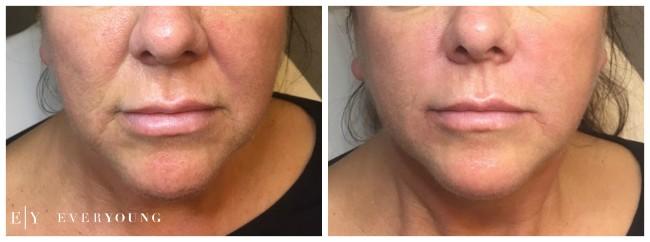 Cosmetic skin care and laser treatments