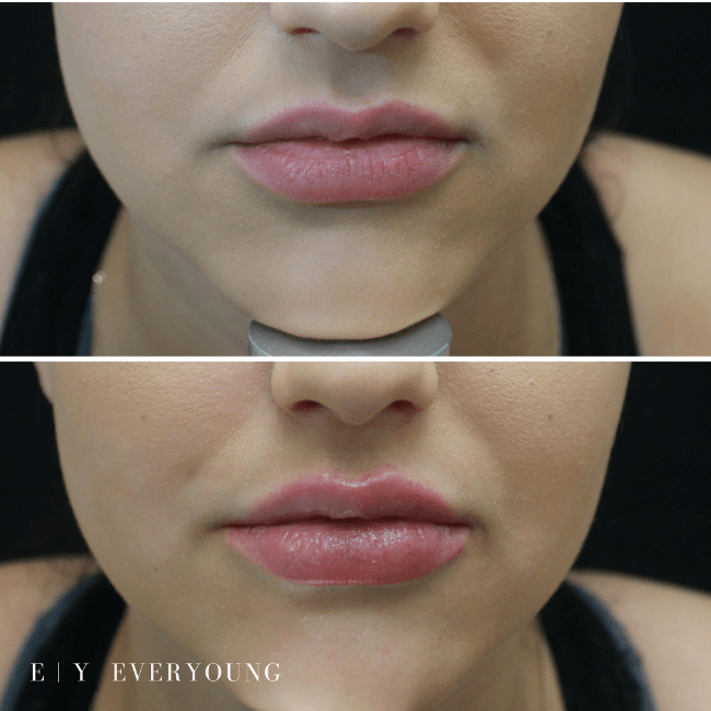Cosmetic skin care and laser treatments