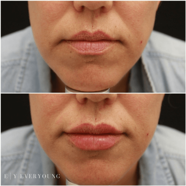 Cosmetic skin care and laser treatments