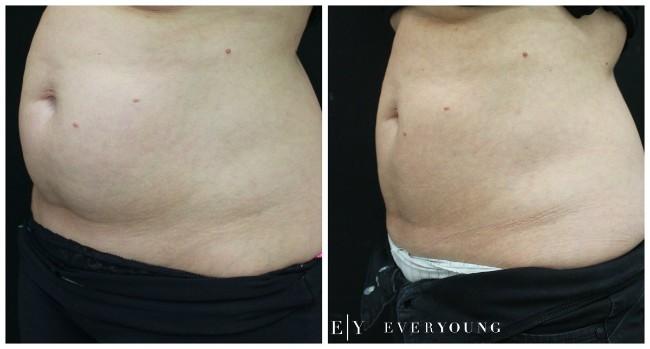 Cosmetic skin care and laser treatments