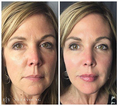 Cosmetic skin care and laser treatments