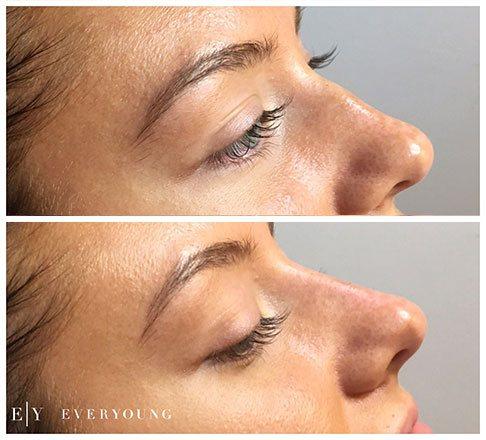 Cosmetic skin care and laser treatments