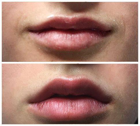 Cosmetic skin care and laser treatments