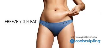 coolsculpting fat freezing