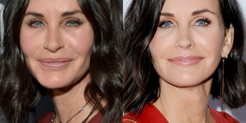 Friends courteney cox too much filler everyoung