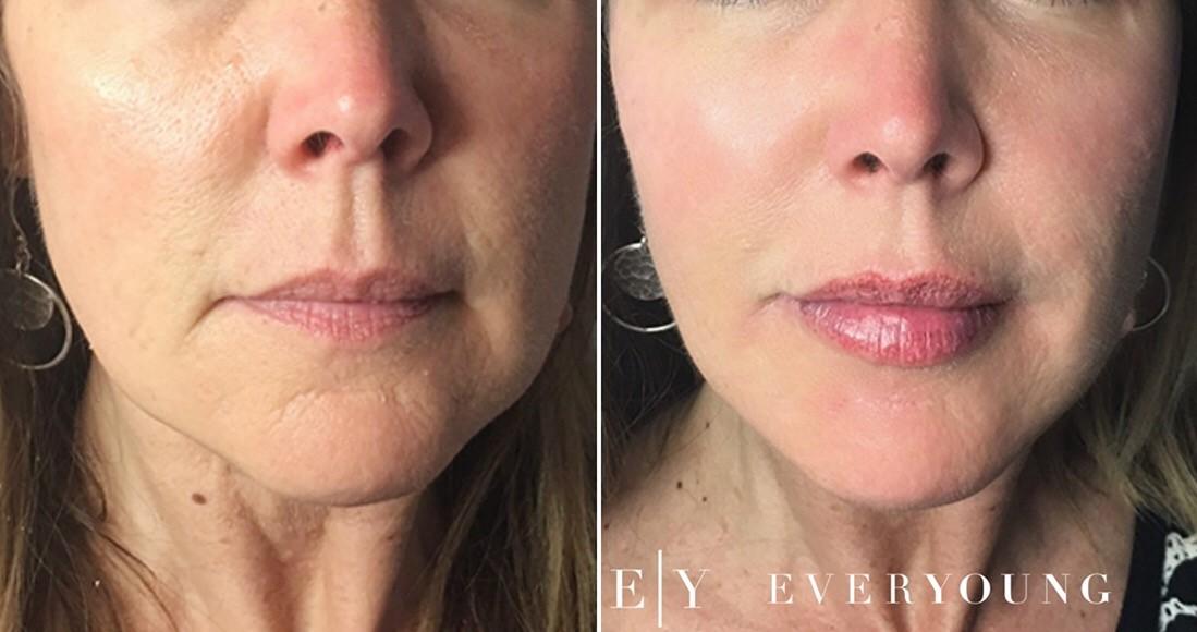 Sculpt a chiseled face #skincare #facesculpting #jawline