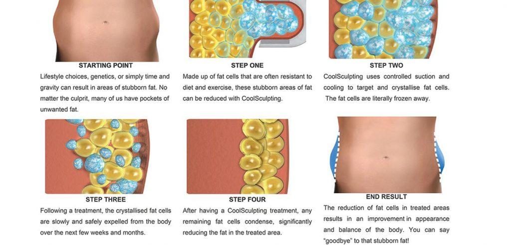 How Much Abdomen Fat Can be Reduced With CoolSculpting® Treatment?