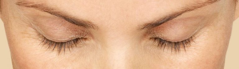 Eyelashes Latisse | EverYoung Skin Care Clinic