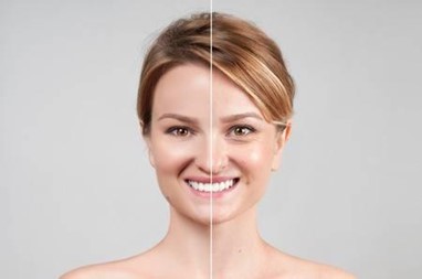 Botox Treatment in Burnaby | EverYoung Skin Care Clinic