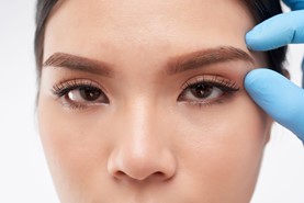 browlift procedure