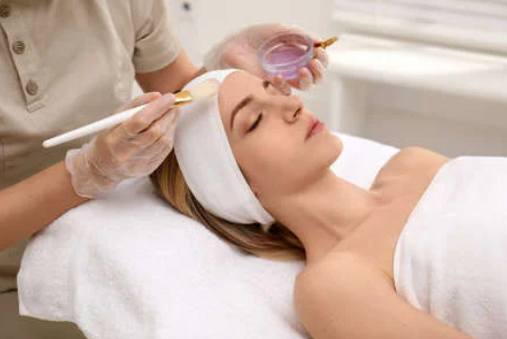what to expect from a chemical peel