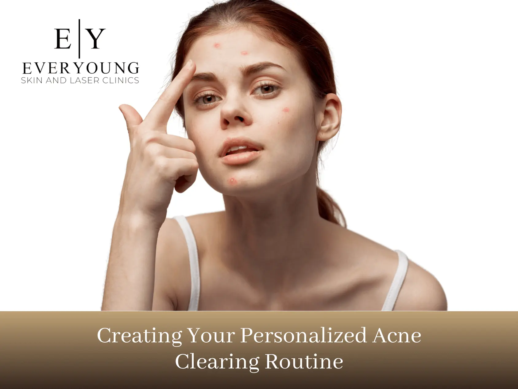 Creating your personalized acne clearing routine