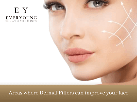 Areas Where Dermal Fillers Can Improve Your Face | EverYoung Skin Care Clinic