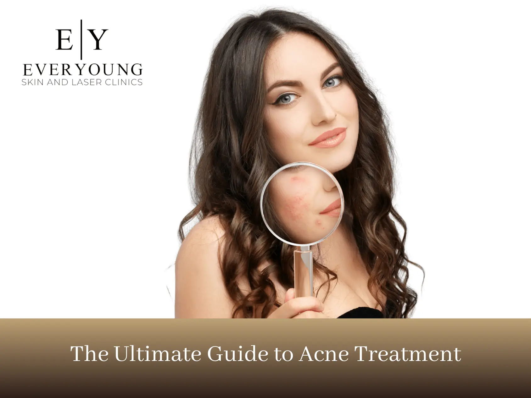 The Ultimate Guide to Acne Treatment | EverYoung Skin Care Clinic
