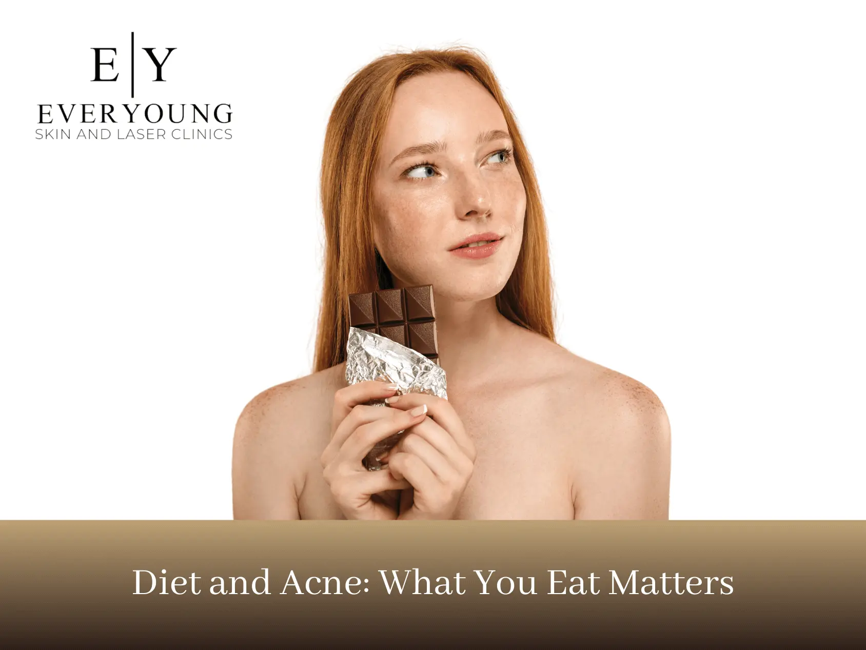 Diet and Acne: What You Eat Matters | EverYoung Skin Care Clinic