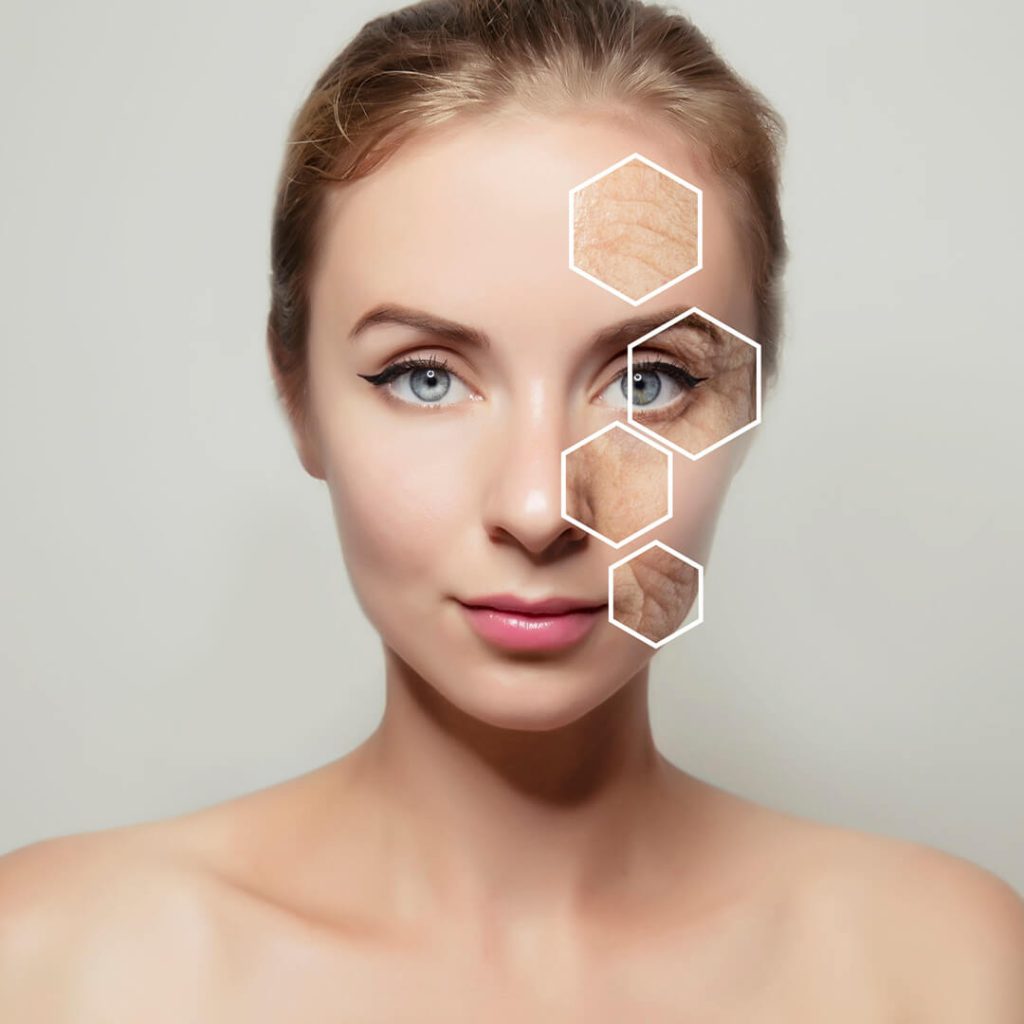 Facial Transformation with Morpheus8 | EverYoung Laser & Skin Clinic Vancouver