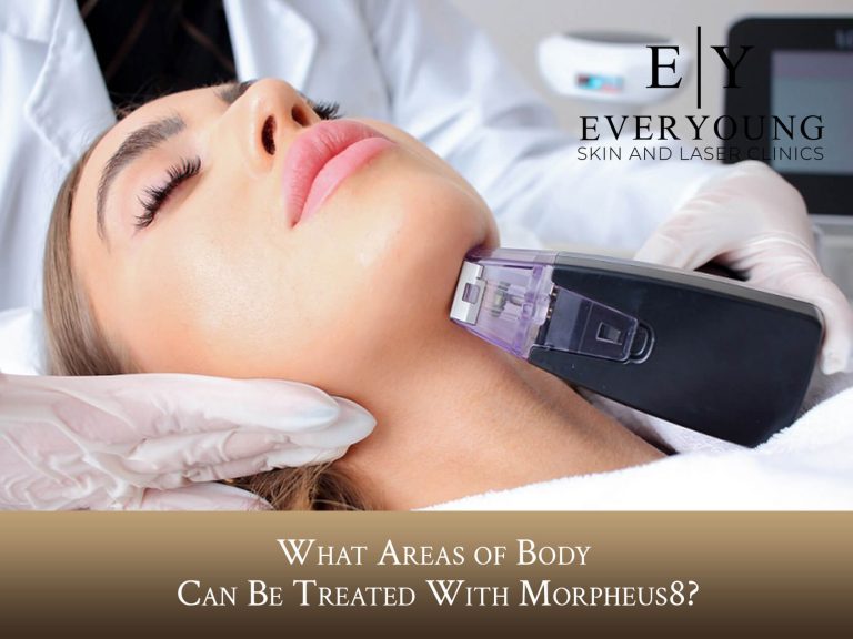 Body Areas Treated with Morpheus8 | EverYoung Skin Clinic