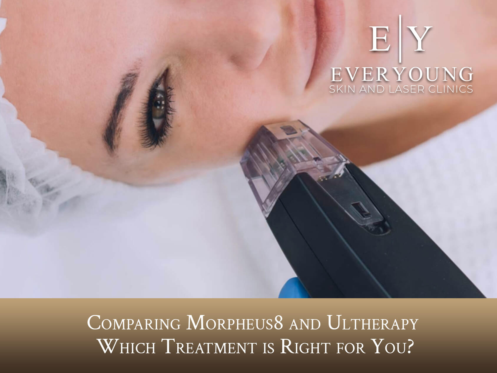 Comparing Morpheus8 and Ultherapy: Which Treatment is Right for You? | EverYoung Medical Aesthetic Centre