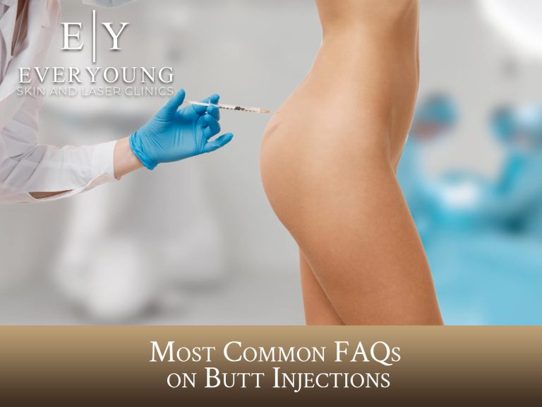 Most Common FAQs on Nonsurgical Butt Injections | EverYoung Skin Care Clinic in Vancouver