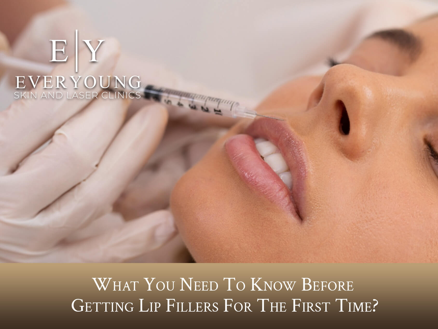 Getting Lip Fillers? What You Should Know | EverYoung Clinic