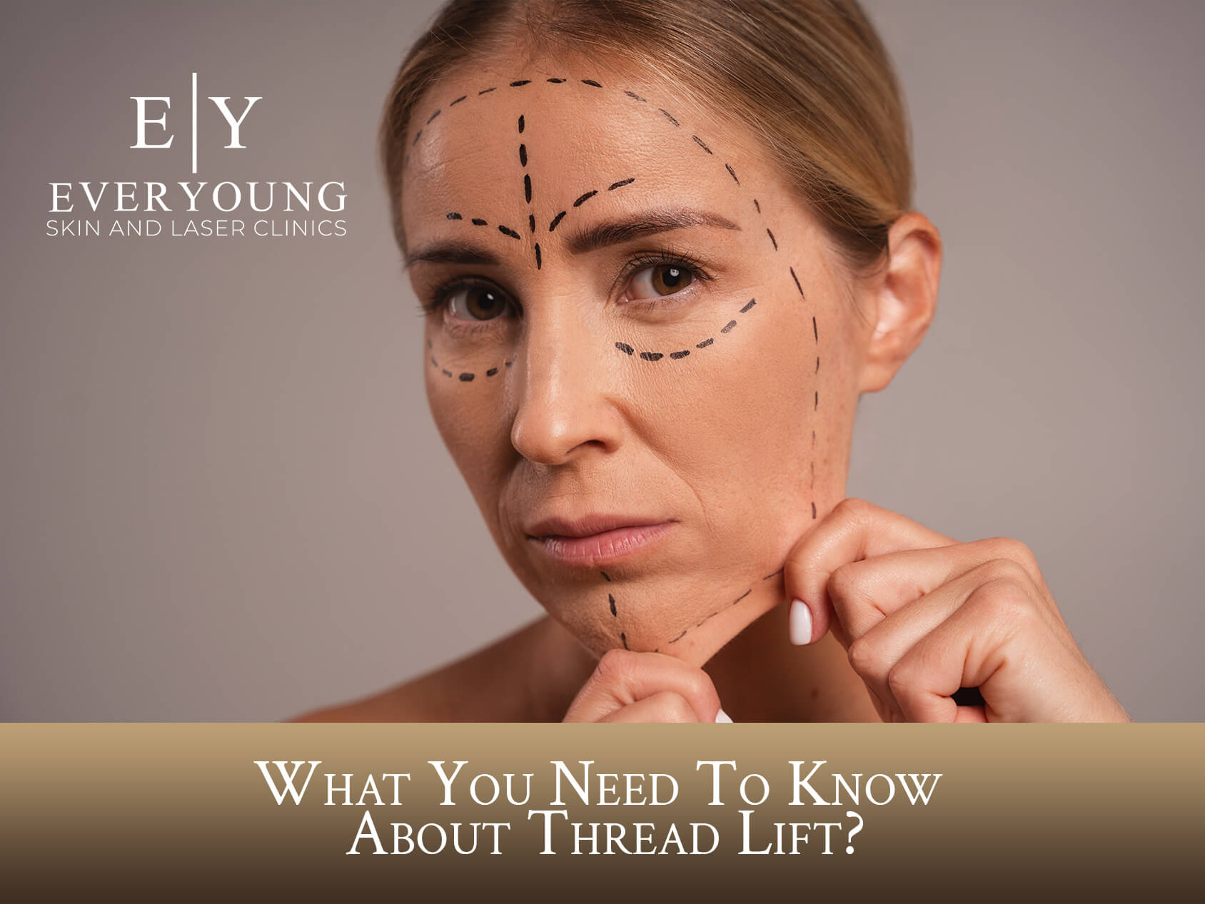 Thread Lift & What You Need To Know | EverYoung Skin Clinic