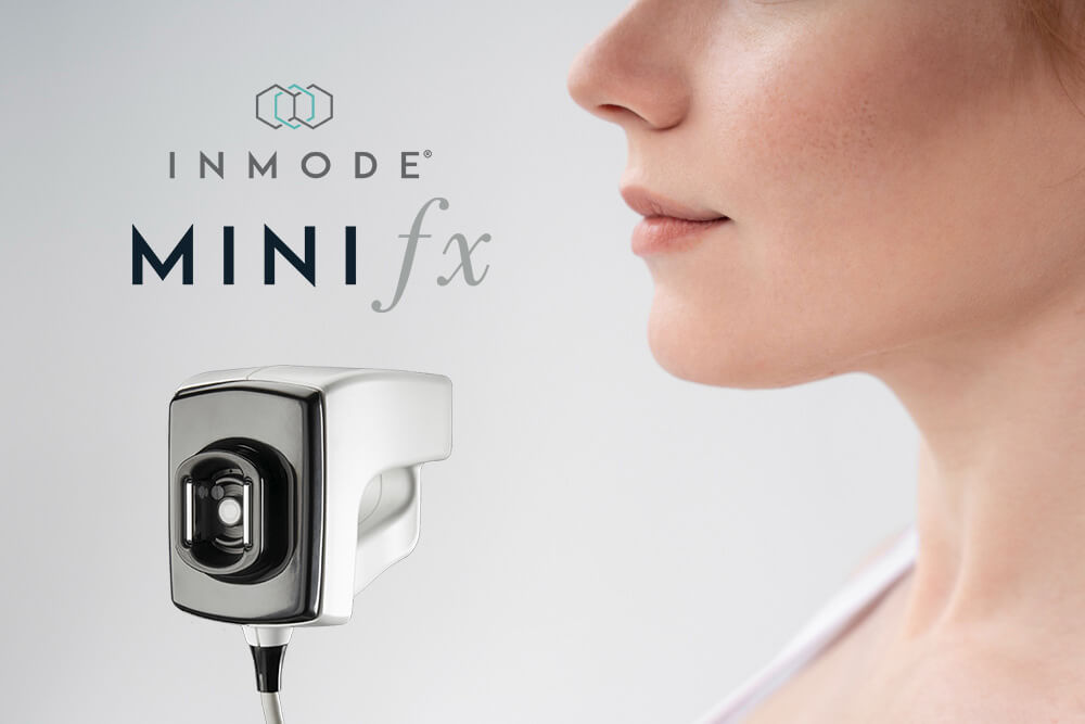 InMode MiniFX Vancouver | EverYoung Laser Skin Clinic