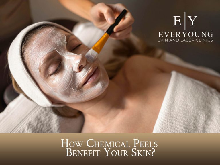 How Chemical Peels Help Your Skin? | EverYoung Skin Clinic