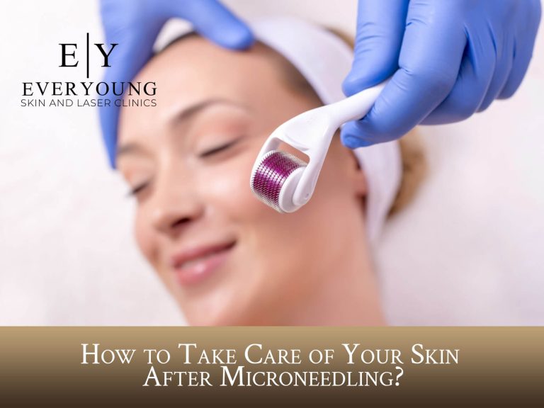 Microneedling Aftercare Guide | EverYoung Skin Clinic