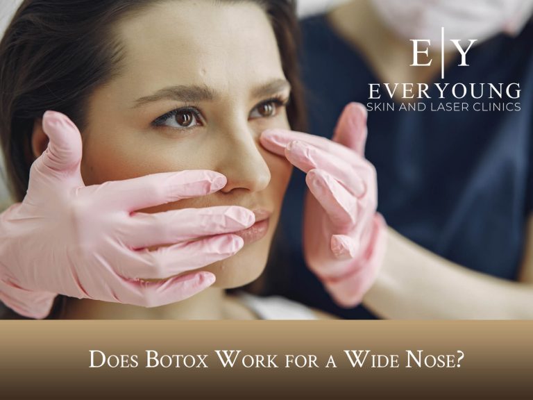 Does Botox Work for a Wide Nose? | EverYoung Skin Clinic