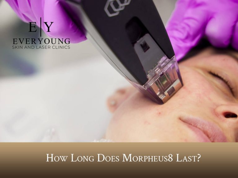 How Long Does Morpheus8 Last? | EverYoung Skin Clinic