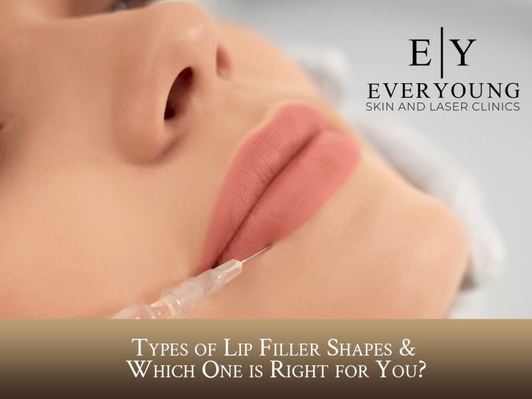 Types of Lip Filler Shapes & How to Choose | EverYoung Laser & Skin Clinic Vancouver