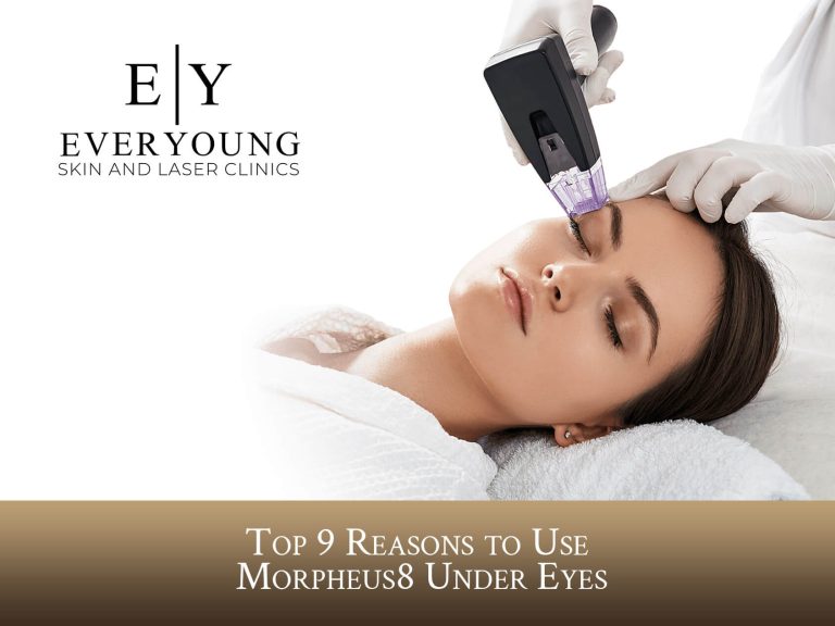 9 Reasons to Use Morpheus8 Under Eyes | EverYoung Skin Care Clinic