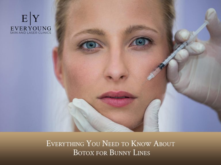 Everything About Botox for Bunny Lines | EverYoung Skin Care Clinic