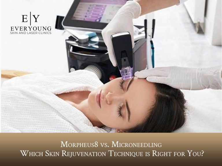 Morpheus8 vs. Microneedling: Which Treatment Is Best? | EverYoung Medical Aesthetics Laser and Skin Clinic​