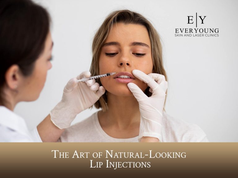 The Art of Natural-Looking Lip Injections | EverYoung Medical Aesthetics Laser and Skin Clinic​