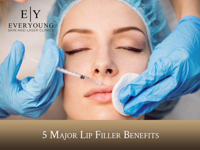 5 Major Lip Filler Benefits | EverYoung Skin Care Clinic