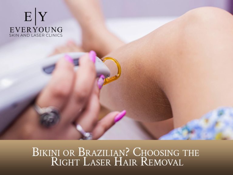 Bikini or Brazilian? Choosing the Right Laser Hair Removal