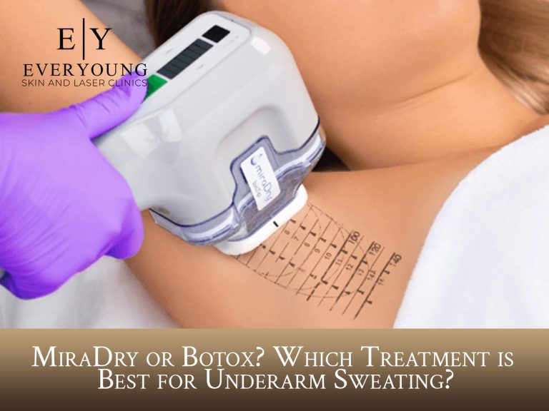 MiraDry or Botox? Which Treatment is Best for Underarm Sweating?