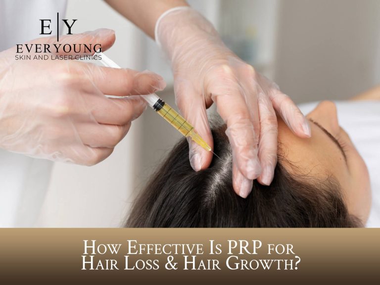 How Effective Is PRP for Hair Loss & Hair Growth? | EverYoung Skin Clinic