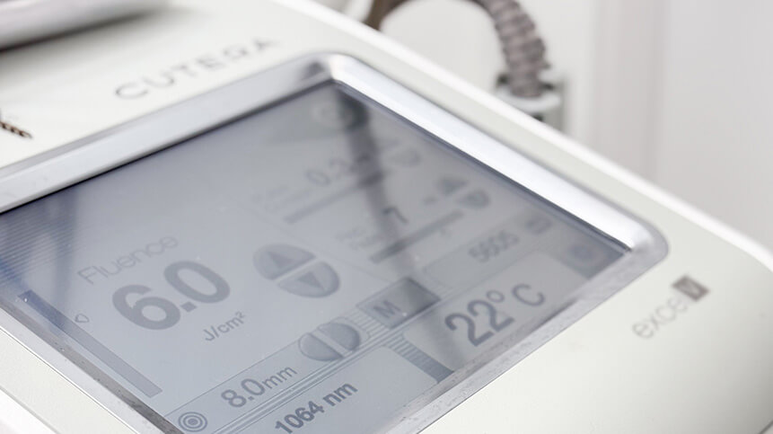Laser Genesis Treatment in Vancouver 1 Laser Genesis Machine | EverYoung Skin Care Clinic