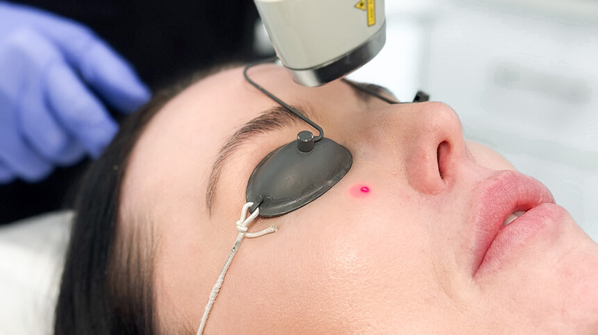 Laser Genesis Treatment in Vancouver 2 Laser Genesis Treatment Vancouver | EverYoung Skin Clinic