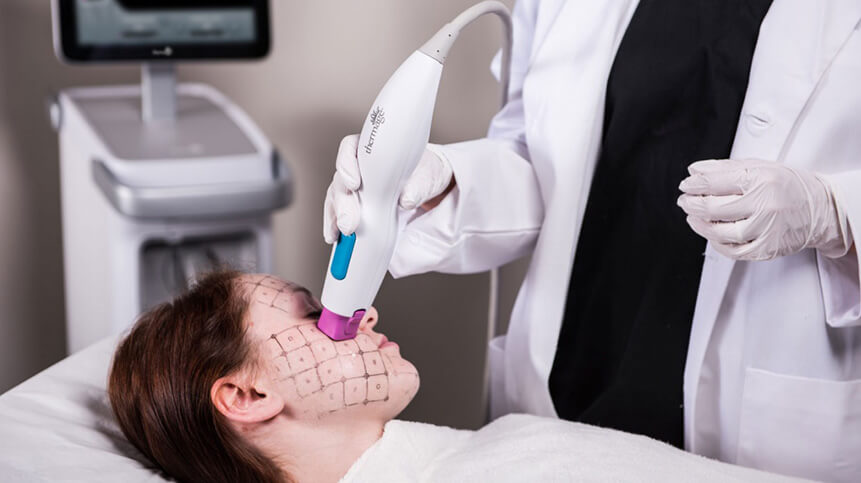 Thermage® FLX Skin Tightening in Vancouver 2 Thermage® FLX Skin Tightening Vancouver | EverYoung Skin Clinic