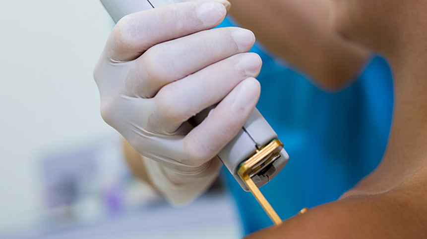 Laser Genesis Treatment in Vancouver 9 using laser genesis machine