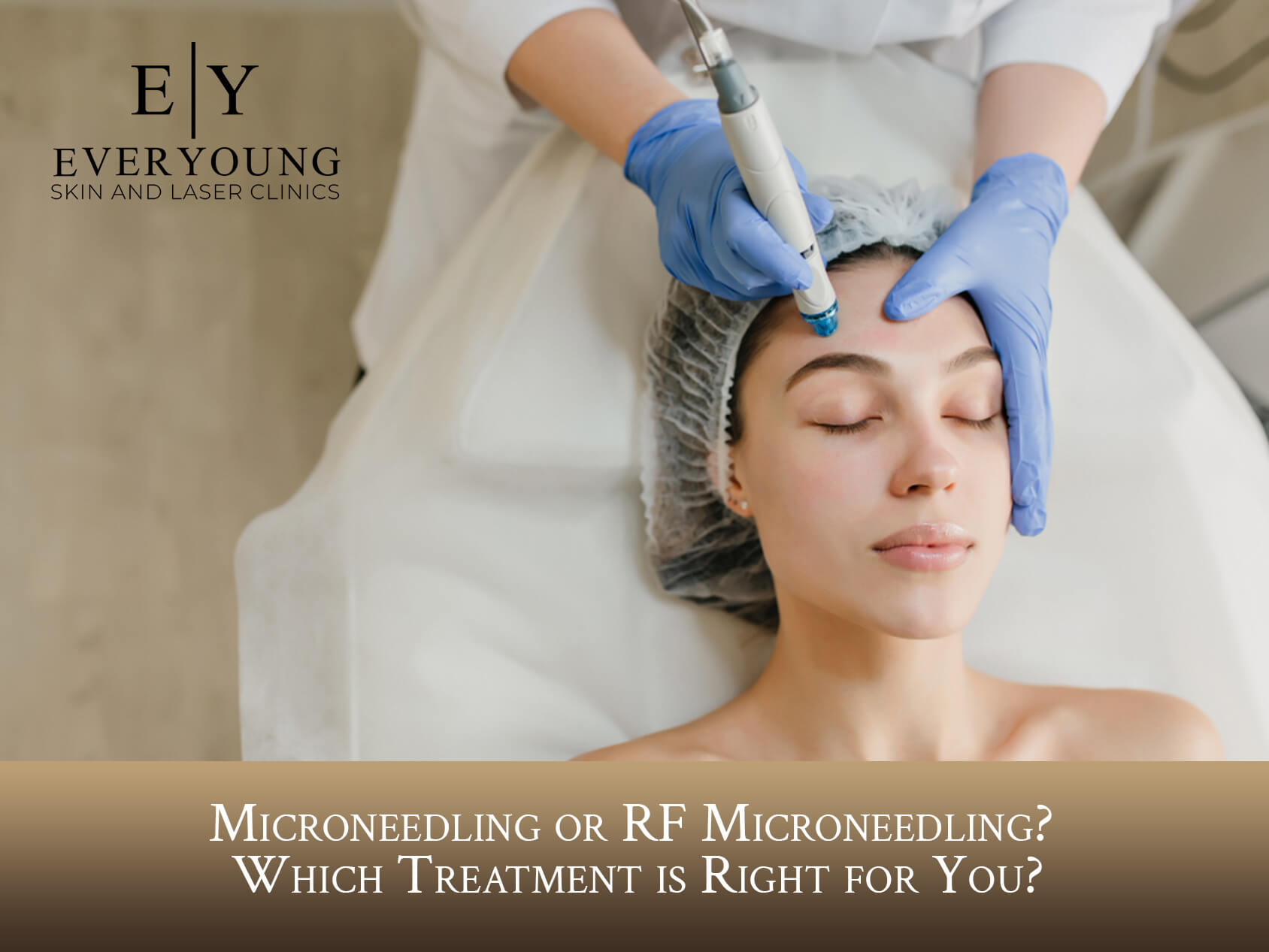 RF Microneedling vs. Microneedling: Which Treatment is Right for You? | EverYoung Skin Clinic