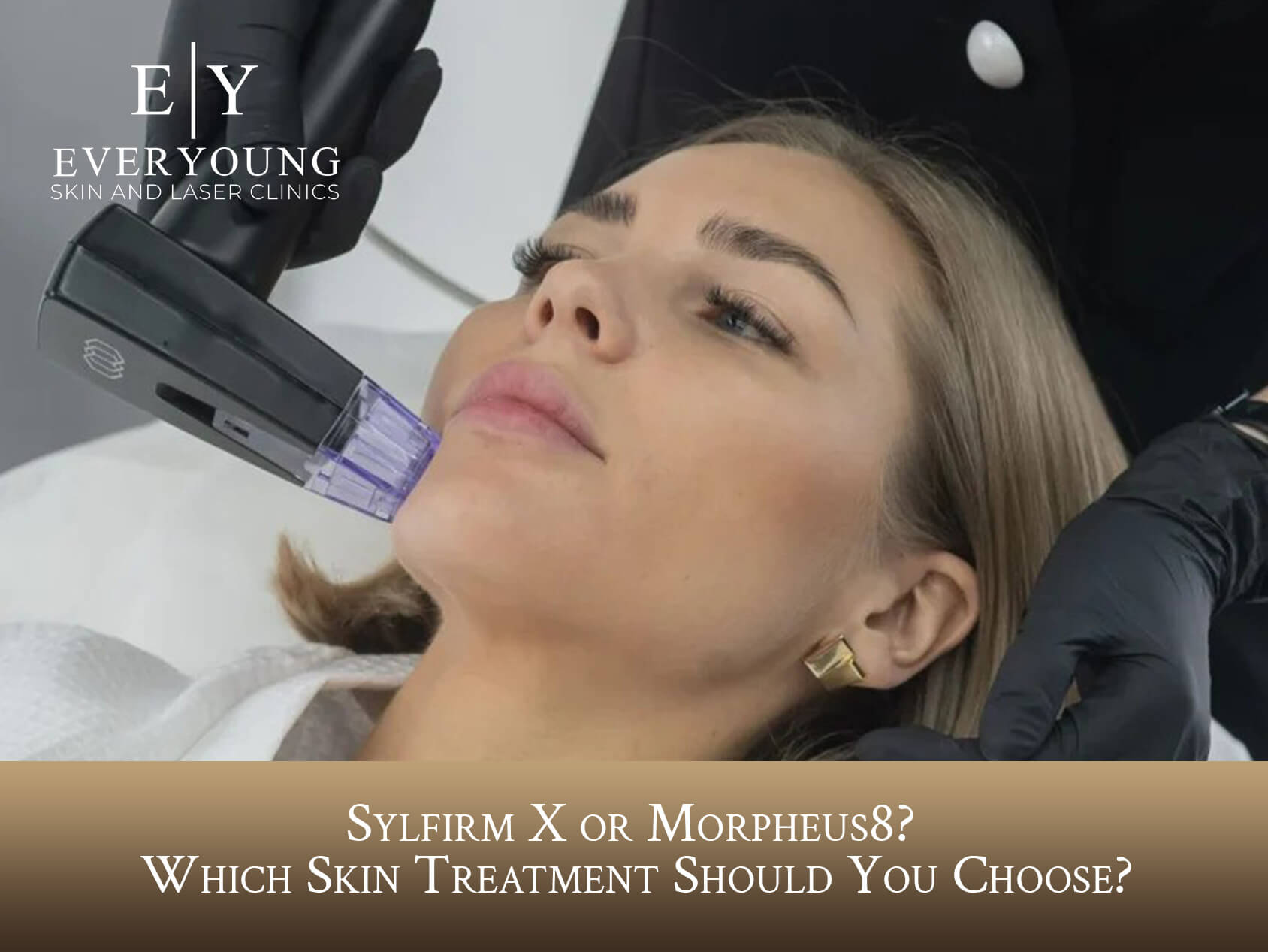 Sylfirm X vs. Morpheus8: Which Skin Treatment Should You Choose? | EverYoung Skin Clinic