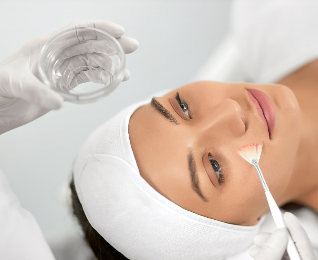 5 Benefits to Getting a Chemical Peel | EverYoung Skin Care Clinic