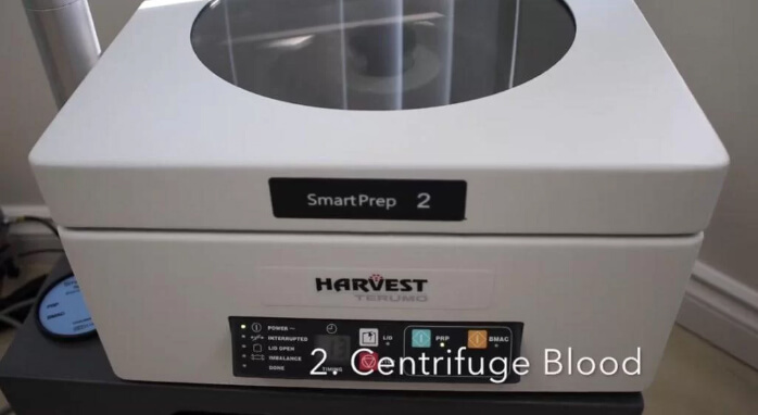 Step 2: Centrifuge Blood | EverYoung Skin Clinic Vancouver