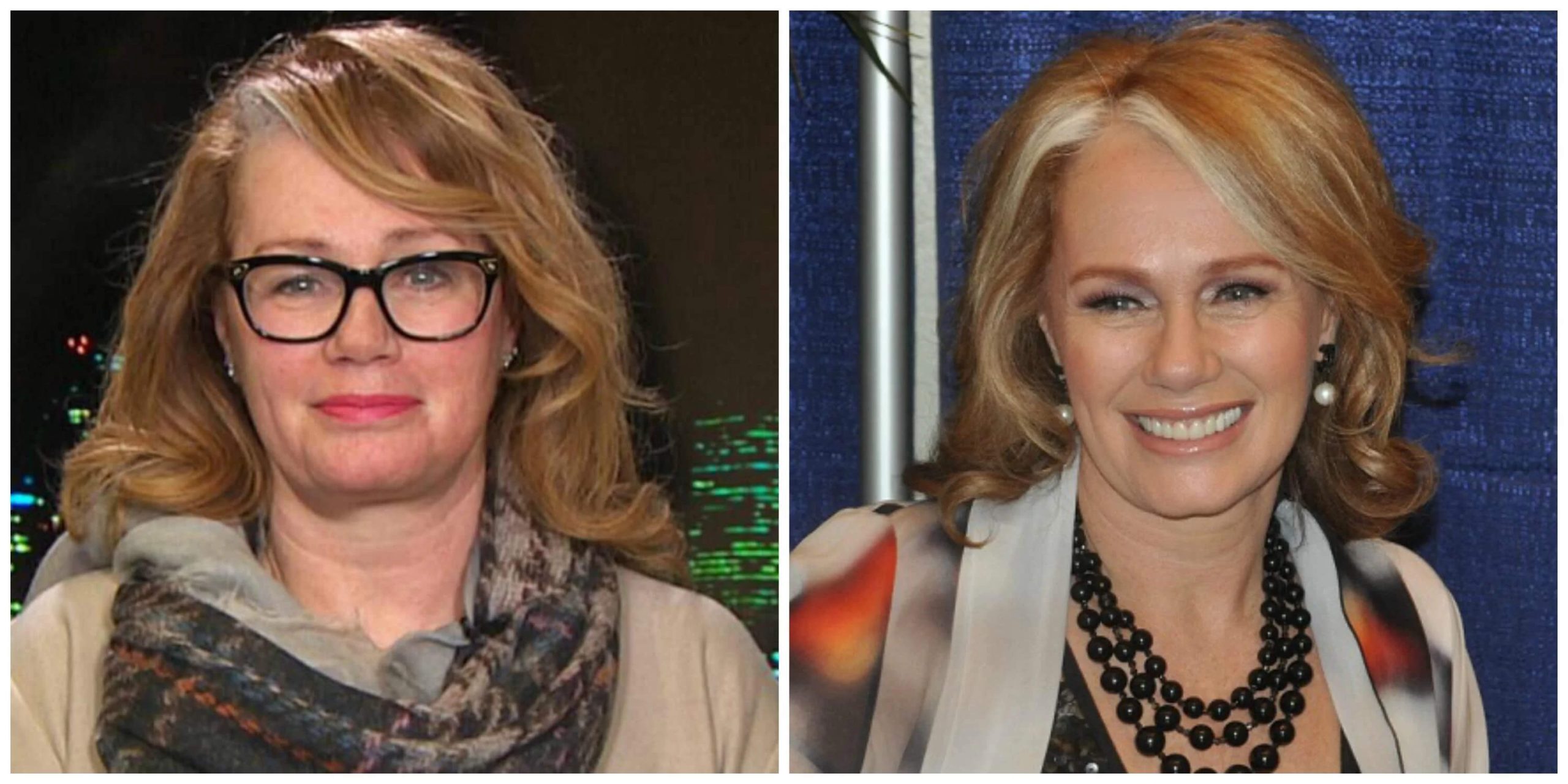 Arlene Dickinson Looks Better Every Decade | EverYoung Skin Care Clinic