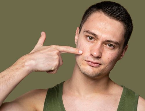 Acne Scar Treatment for Different Skin Types. Common Acne Scarring Triggers. Using Blue Light Therapy for Acne Treatments