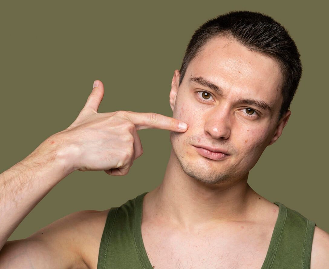 Acne Scar Treatment for Different Skin Types Using Blue Light Therapy | EverYoung Skin Care Clinic